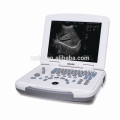 DW500 12 Zoll LED-Bildschirm billige Krankenhaus Arzt verwenden Laptop Ultraschall-Maschine und Laptop Ultraschall-Maschine
